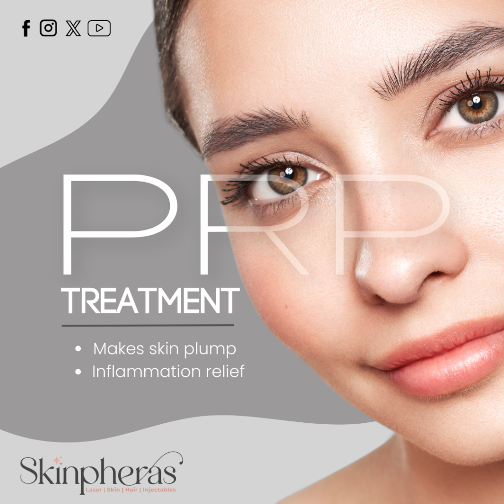 Copy of CALEE POST 18