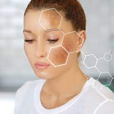 Addressing Common Skin Concerns: Solutions for Every Need – Skinpheras Clinic