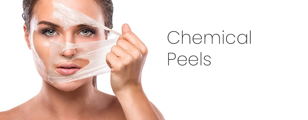 Chemical Peels Vs. Laser Treatments: Which Is Right For You?