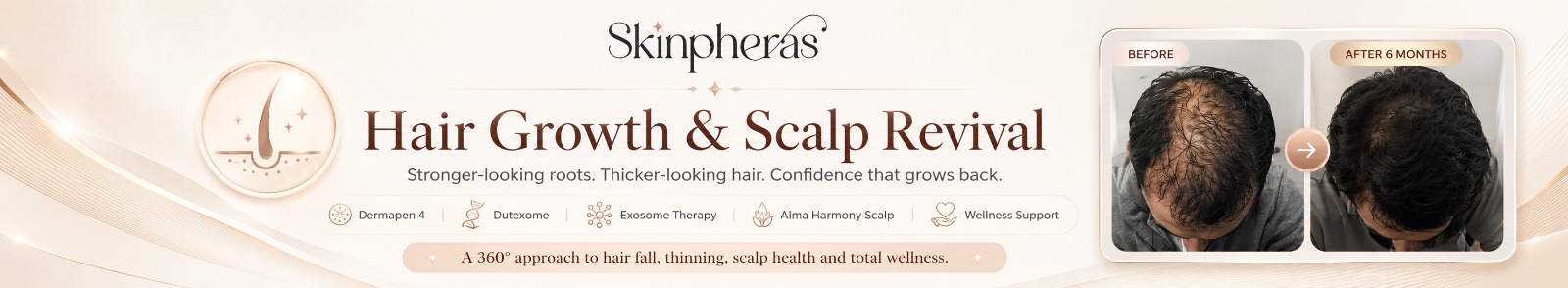 Skinpheras Hair Growth & Scalp Revival